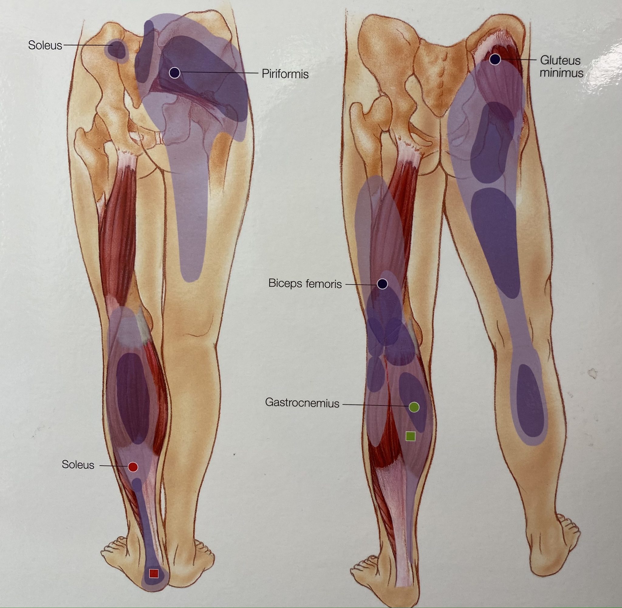 Trigger Point Grand Rond Myofascial Trigger Points - Quay Health